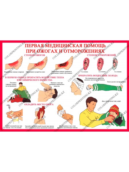 Первая медицинская помощь при ожогах отморожения 1 плакат